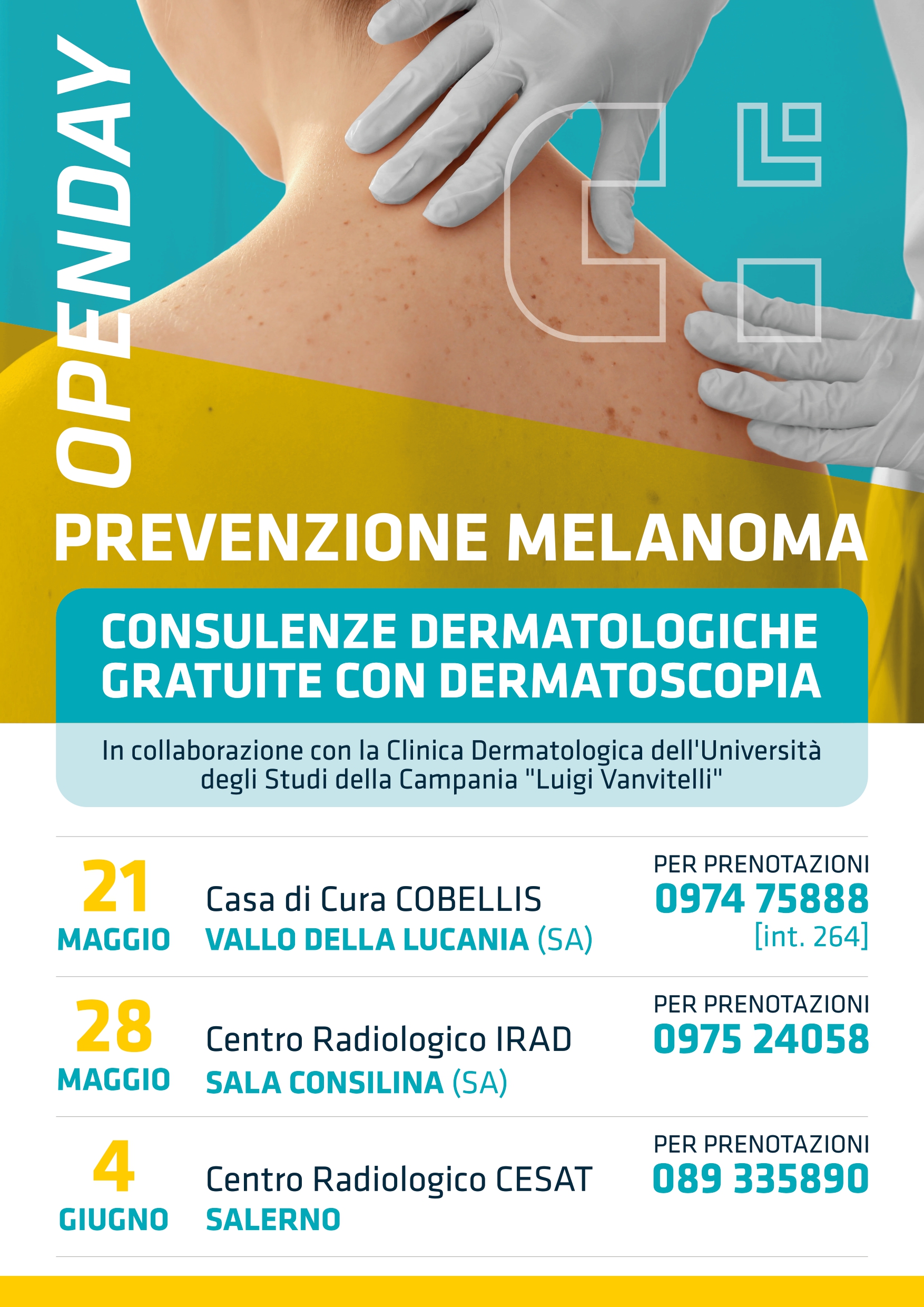 Vallo della Lucania: Casa di Cura Cobellis, 3 giornate su screening melanoma